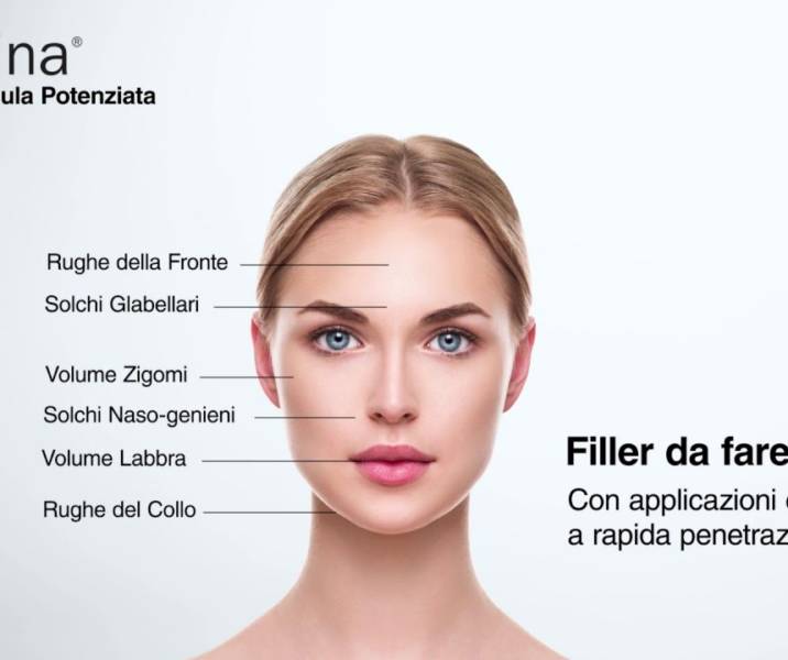 Fillerina
